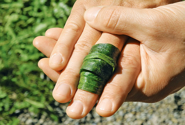 Insektenstich; Leseprobe; Natürliche Heilmittel